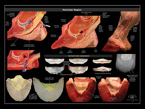 aote navicular poster