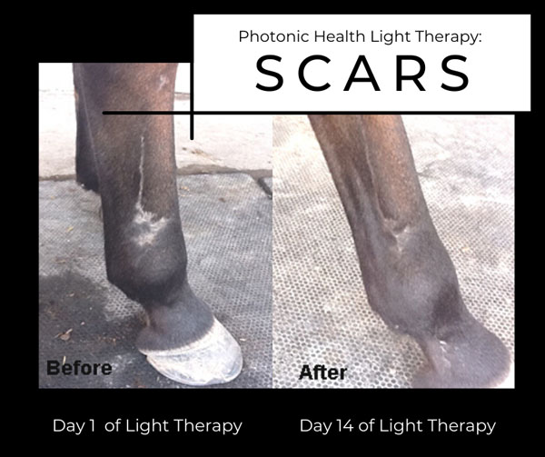 Photonic Health testimonial scars